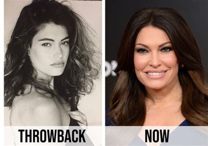Unveiling The Mysteries: What Happened To Kimberly Guilfoyle's Face?