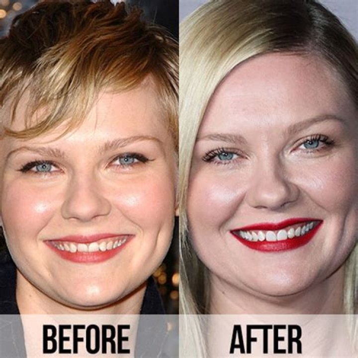 Unveiling The Secrets Of Kirsten Dunst's Teeth Transformation
