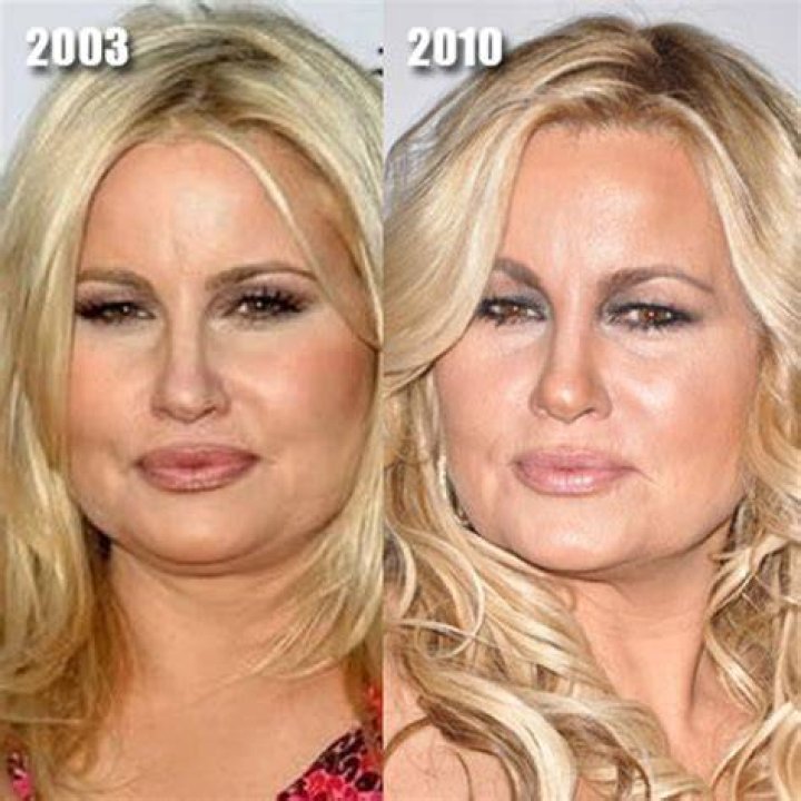 Unveiling The Secrets Of Youthful Brilliance: Jennifer Coolidge