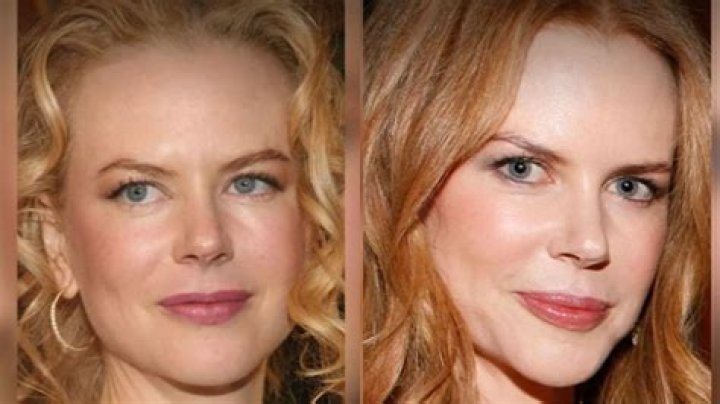 Unveiling The Transformation: Nicole Kidman Before And After Plastic Surgery Photos
