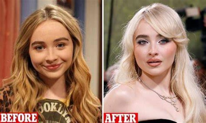 Unveiling The Transformation: Sabrina Carpenter Before Filler