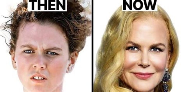 Unveiling The Truth Behind Nicole Kidman Implants