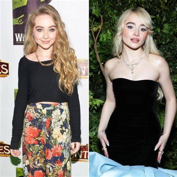 Unveiling The Truth: Has Sabrina Carpenter Ever Had Plastic Surgery?