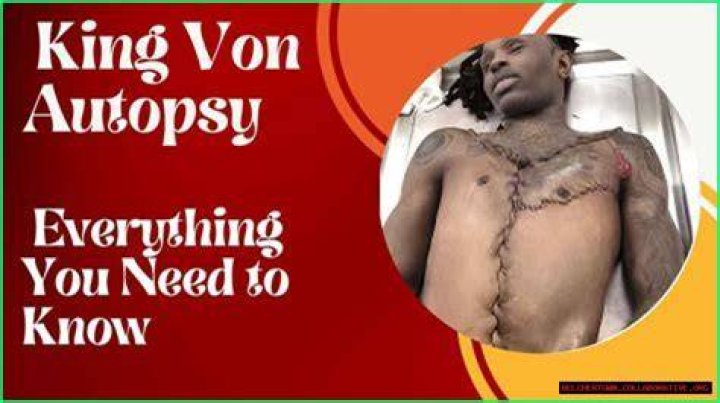 Unveiling The Truth: King Von's Autopsy