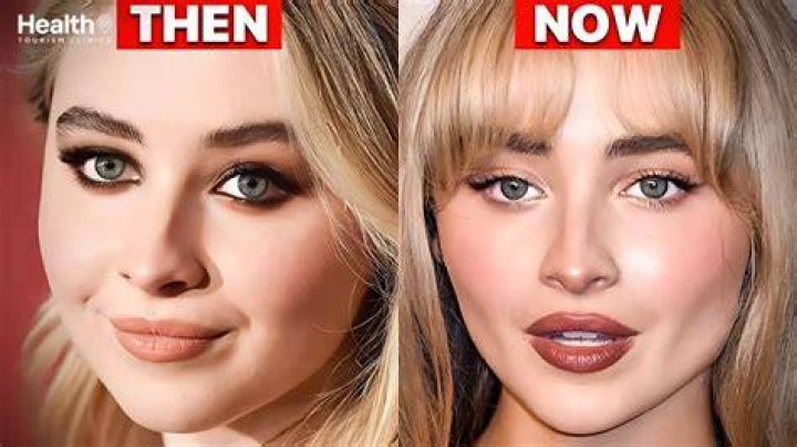 What Plastic Surgery Has Sabrina Carpenter Had? Expert Insights