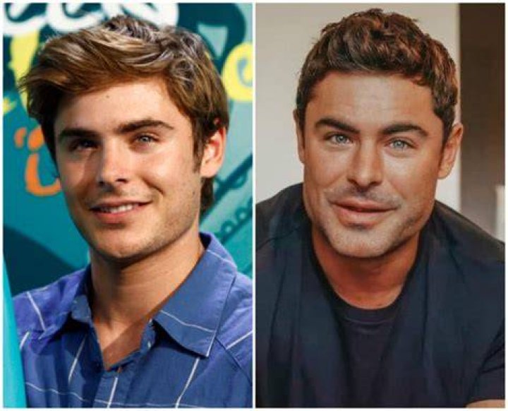 Zac Efron: Discovering His Age And Journey Now