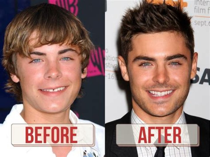Zack Efron 2024: The Evolution Of A Star